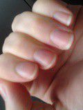 Mon astuce miracle contre les ongles jaunis